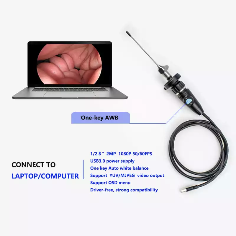 USB3.0 1080p Full HD Medical Portable Endoscopic High Resolution CMOS Endoscope Camera For ENT Laparoscope Gynecology