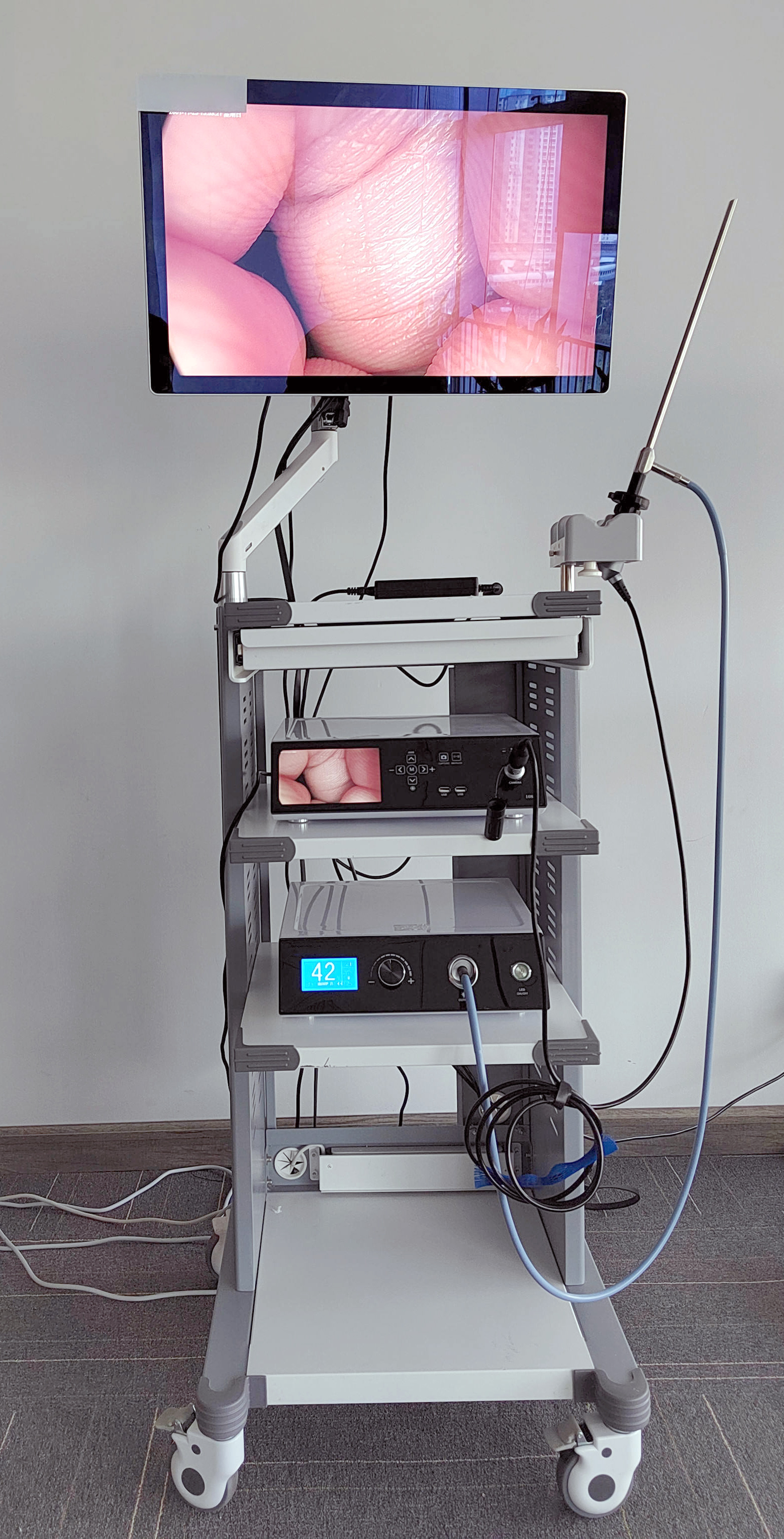 Appareil d'endoscopie médicale Full HD Système d'endoscopie vidéo pour ORL Laparoscope Hystéroscopie