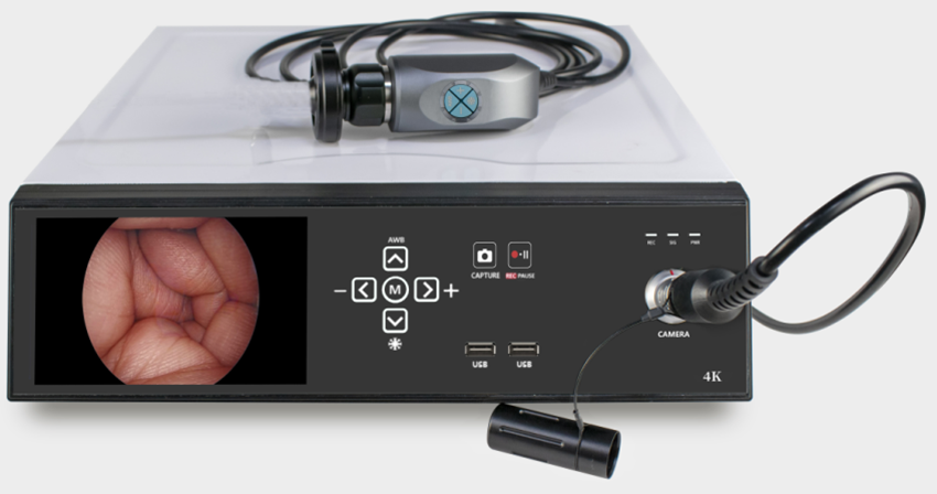 Appareil d'endoscopie médicale Full HD Système d'endoscopie vidéo pour ORL Laparoscope Hystéroscopie