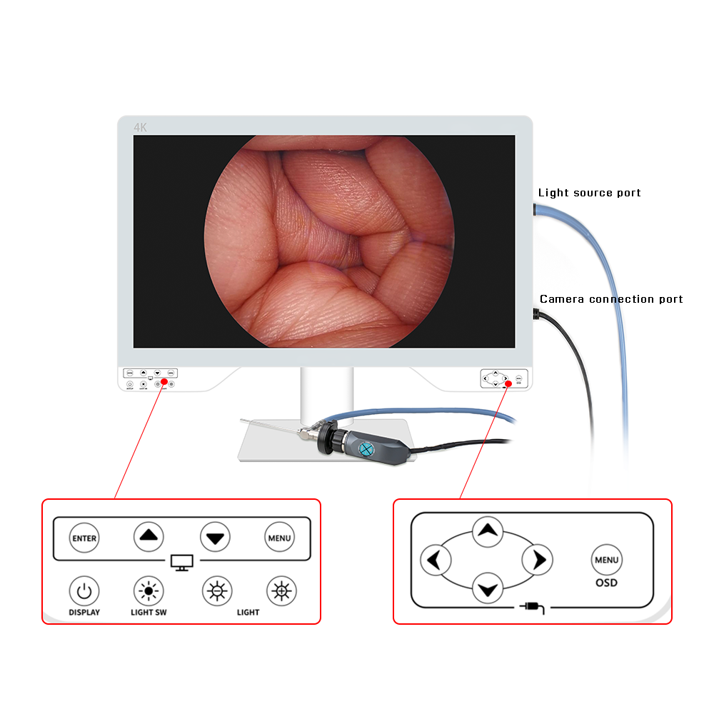 Ultra HD 4K Medical Endoscope Camera Imaging System Surgical Monitor