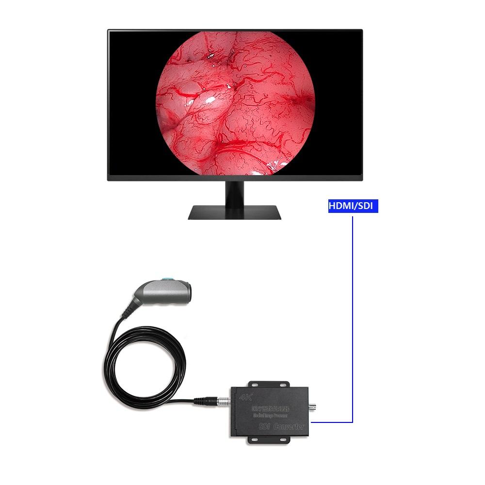 4K UHD Portable Medical Camera System Endoscope Image Processor For Mac Windows Monitor