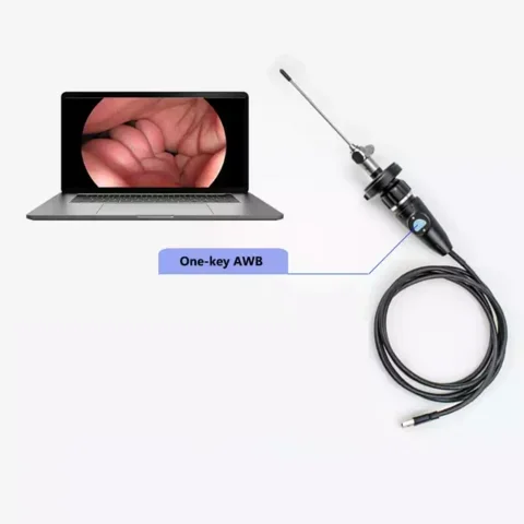Full HD USB Portable Medical Laparoscope Camera For Endoscopic Ent
