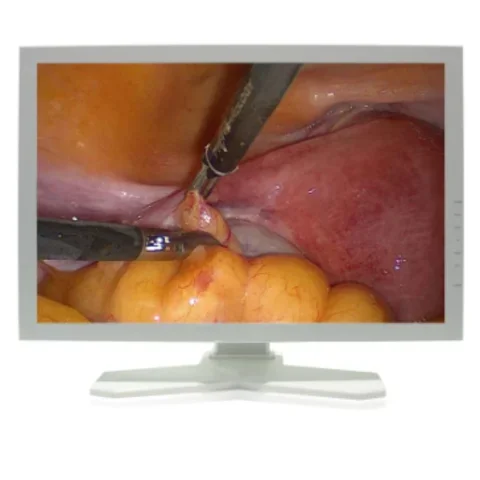 Full HD medical monitor