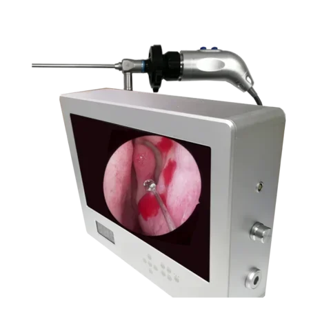 1080P Integrated camera system for surgery /Portable endoscopy camera system