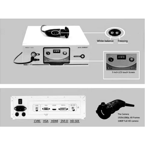 Full HD endoscopy camera