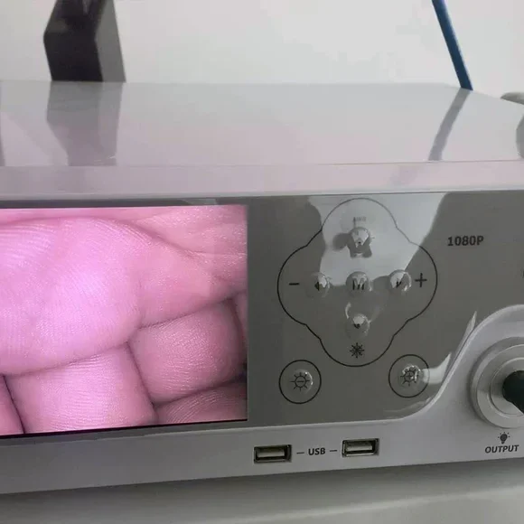 ENT Endoscopy Camera Unit Laparoscopic Arthroscopy Medical Endoscope Camera With Light Source System