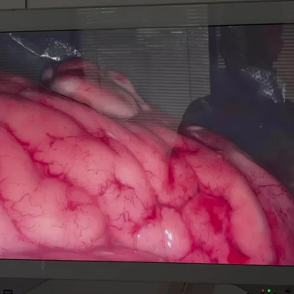 27inch All In One Ultra HD 4K Medical Grade Monitor For Endoscope Laparoscopic System With Optic Light Source