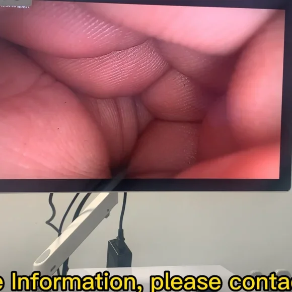 4K Digital Video Camera System Medical Endoscope Camera With Led Light Source