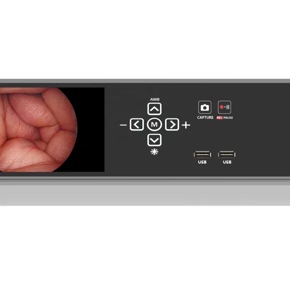 1080p Video Endoscopy Machine Medical Endoscope Camera For Laparoscope Spine Arthroscope Gynecological With USB Record