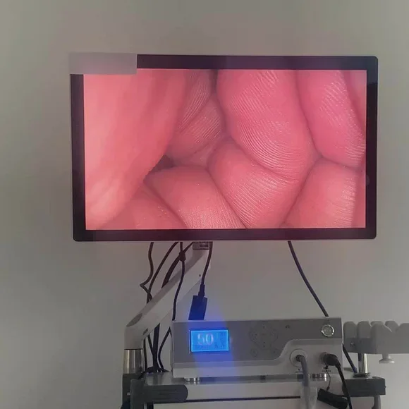 4K UHD 100W Light Source Medical Endoscope Camera System For Laparoscopy ENT Arthroscope
