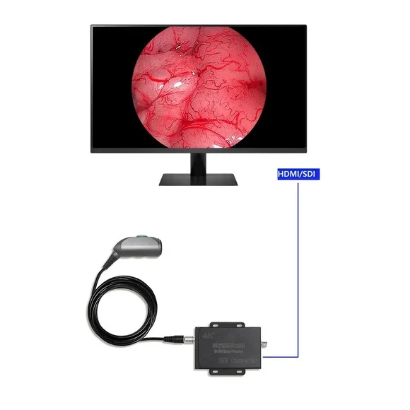 4K UHD Portable Medical Camera System Endoscope Image Processor For Mac Windows Monitor