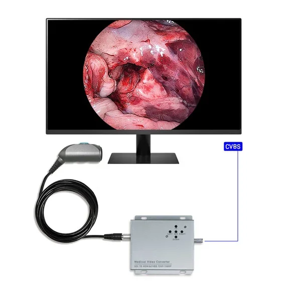 Full HD Portable Medical Endoscope Camera Unit Video ENT Endoscope