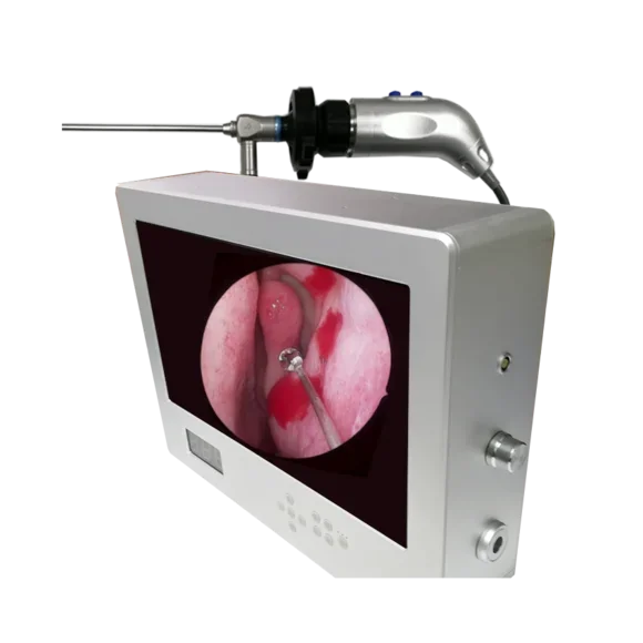 HD portable camera system/HD Portable endoscopy camera system for veterinary surgery
