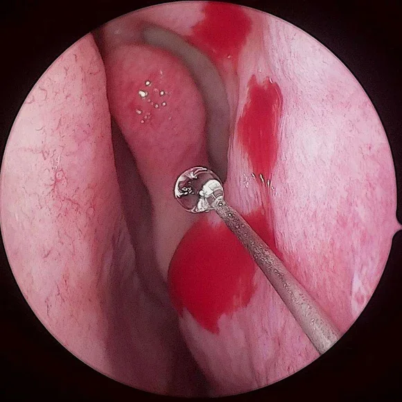 HD portable camera system/HD Portable endoscopy camera system for veterinary surgery