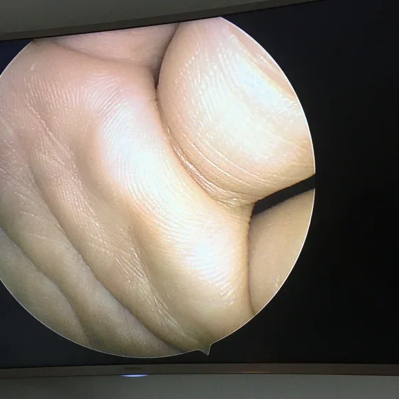 Full HD endoscopy camera with LED light source