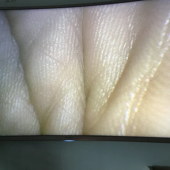 Full HD endoscopy camera with LED light source