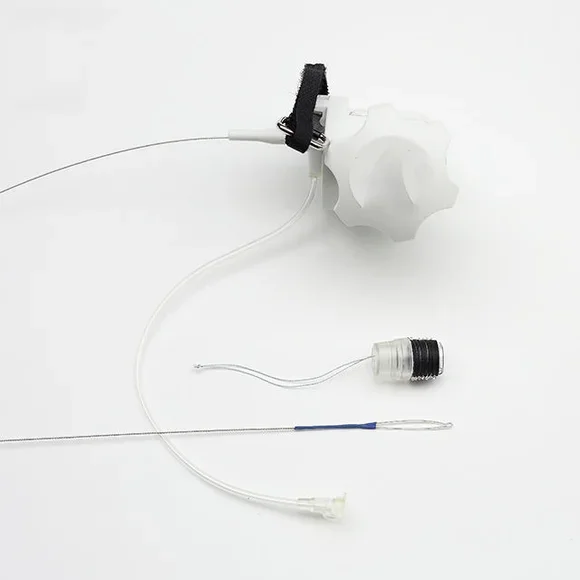 Esophageal Varices Band Ligation